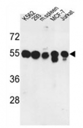 AP53413PU-N - Protein phosphatase 1H / PPM1H