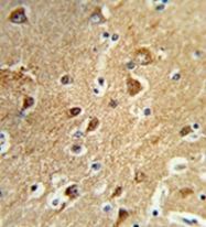 AP53413PU-N - Protein phosphatase 1H / PPM1H