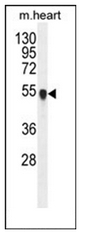 AP53414PU-N - Protein phosphatase 1L / PPM1L