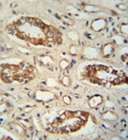 AP53414PU-N - Protein phosphatase 1L / PPM1L