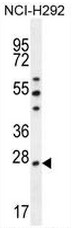 AP53439PU-N - Peroxiredoxin-4 / PRDX4