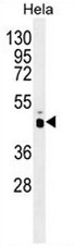 AP53443PU-N - AMPK gamma-1 chain / AMPKg