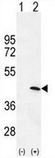 AP53443PU-N - AMPK gamma-1 chain / AMPKg