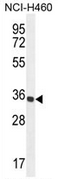 AP53464PU-N - Trypsin-1 / PRSS1