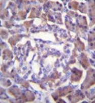 AP53469PU-N - Trypsin-3 / PRSS3
