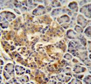 AP53470PU-N - Trypsin-3 / PRSS3