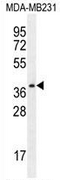 AP53470PU-N - Trypsin-3 / PRSS3