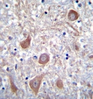 AP53494PU-N - PTCHD1