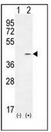 AP53503PU-N - Twinfilin-2 (TWF2)