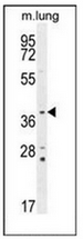AP53503PU-N - Twinfilin-2 (TWF2)