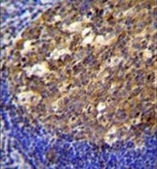 AP53503PU-N - Twinfilin-2 (TWF2)