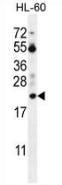 AP53504PU-N - Prothymosin alpha