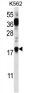AP53505PU-N - Parathymosin / PTMS
