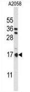 AP53506PU-N - Parathymosin / PTMS