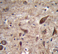 AP53507PU-N - Pleiotrophin / PTN