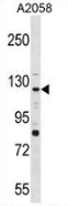 AP53516PU-N - PTPRN2