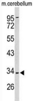AP53526PU-N - Peroxin 2 / PEX2 / RNF72