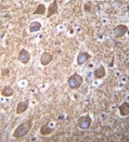 AP53590PU-N - RASGRP2