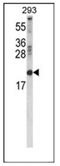 AP53617PU-N - Retinol-binding protein 2 / RBP2