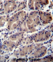AP53694PU-N - RNF5