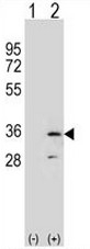AP53702PU-N - RPA2