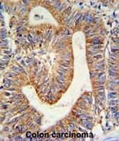 AP53709PU-N - RPL17
