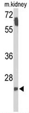 AP53946PU-N - SMNDC1