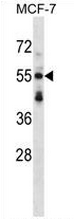 AP53969PU-N - Syntrophin-3 / SNTB2