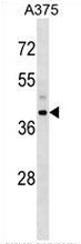 AP53970PU-N - Snurportin-1 (SNUPN)