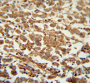 AP54004PU-N - Speriolin / SPATC1