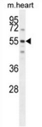 AP54004PU-N - Speriolin / SPATC1