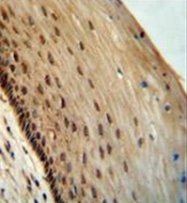 AP54010PU-N - SPDYE3