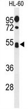 AP54026PU-N - CD43 / Leukosialin