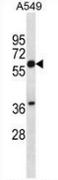 AP54036PU-N - Squalene epoxidase / SQLE