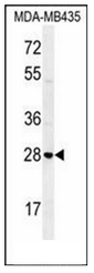 AP54088PU-N - Syntaxin 19 / STX19