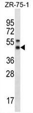 AP54092PU-N - Syntaxin 5 / STX5