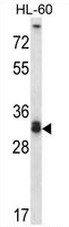 AP54093PU-N - Syntaxin 6 / STX6