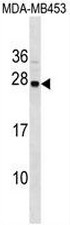AP54125PU-N - Synaptogyrin-1 / SYNGR1