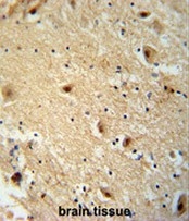 AP54164PU-N - TBC1D14