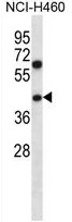 AP54167PU-N - TBC1D22A