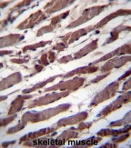 AP54167PU-N - TBC1D22A
