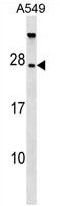 AP54169PU-N - TBC1D28