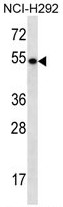 AP54171PU-N - TBC1D3F