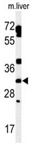 AP54177PU-N - TBC1D7