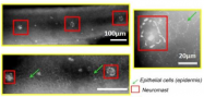 AP54853SU-N - Collagen type IV alpha 3 chain