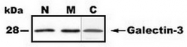 AP54962SU-N - Galectin-3