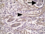 AP55072SU-N - Meckelin