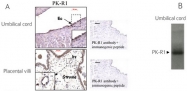 AP55202PU-N - GPR73 / Prokineticin receptor 1