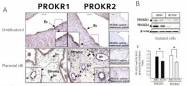 AP55204PU-N - GPR73b / Prokineticin receptor 2