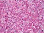 AP55276PU-N - SCN1A